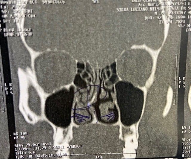 Cláudio Lindemberg-4