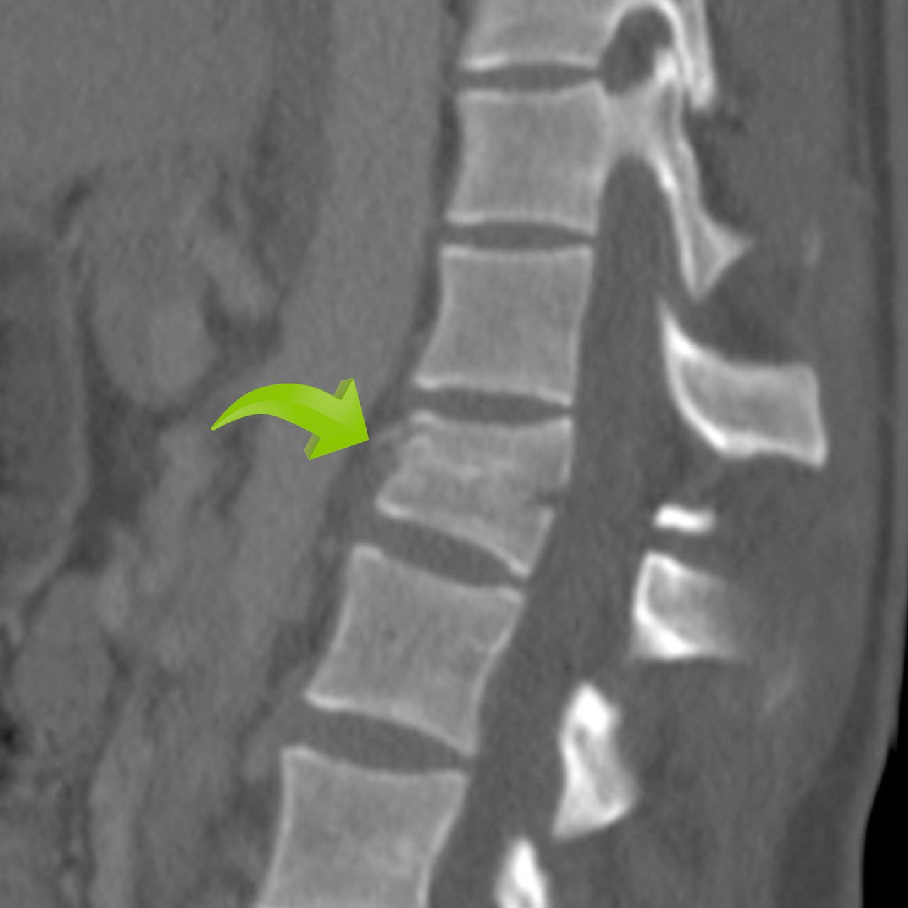 David Tafur Muñoz-1127