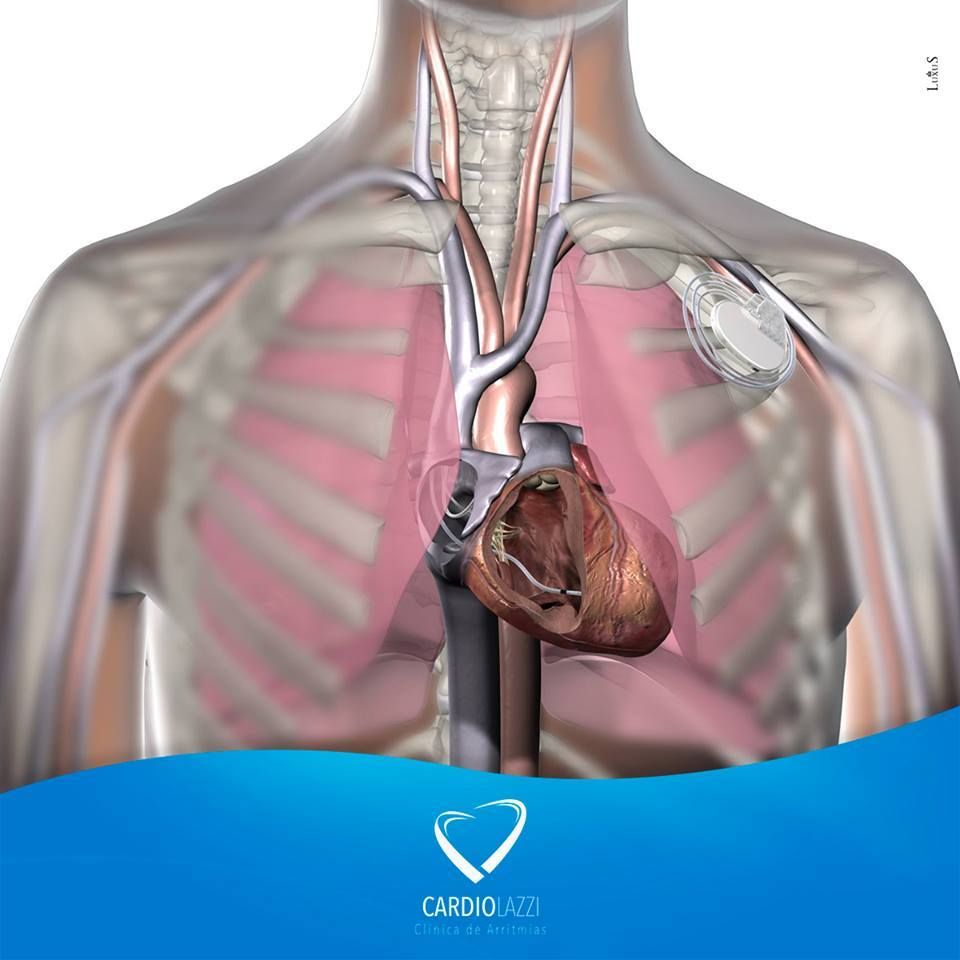 Frederico Bartolazzi-11