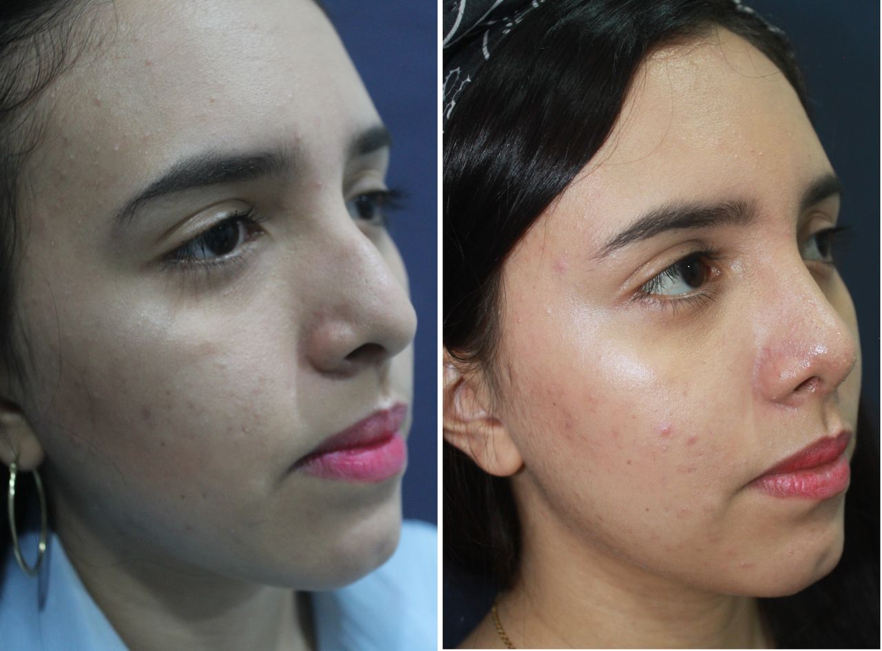 Jorge A Holguin Ruiz-36