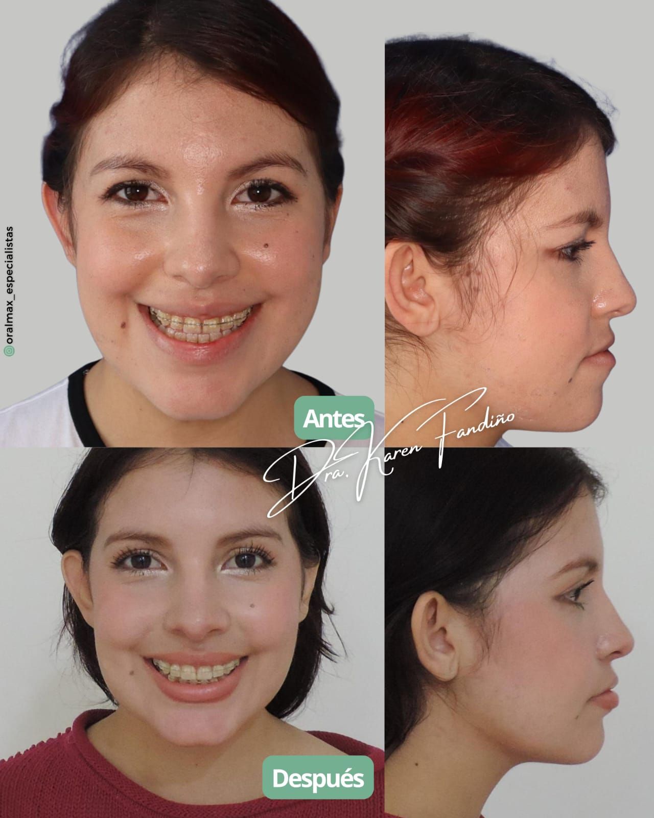 Karen Fandiño Avila-9