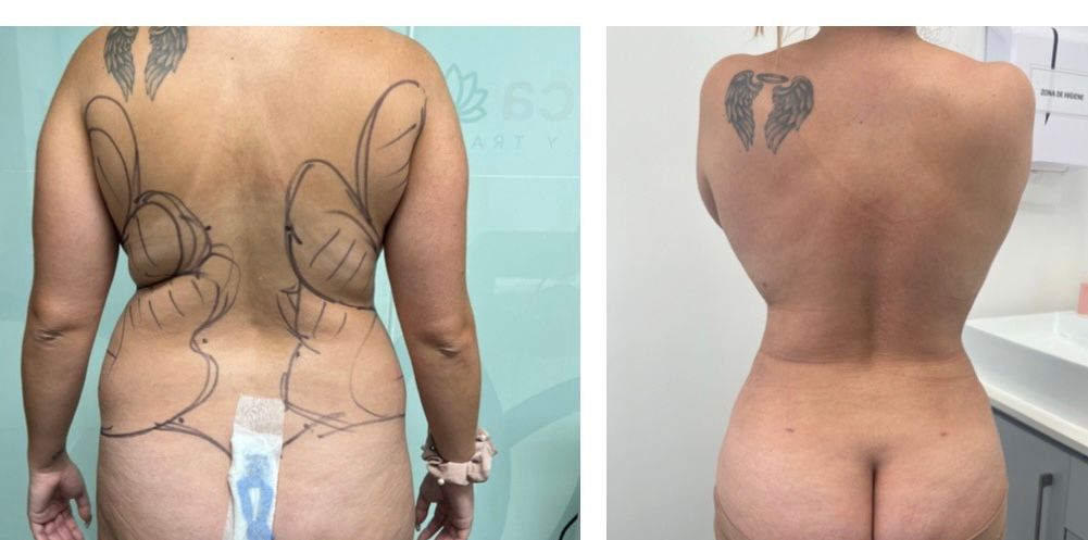 Fernando Oviedo Monsalve-5