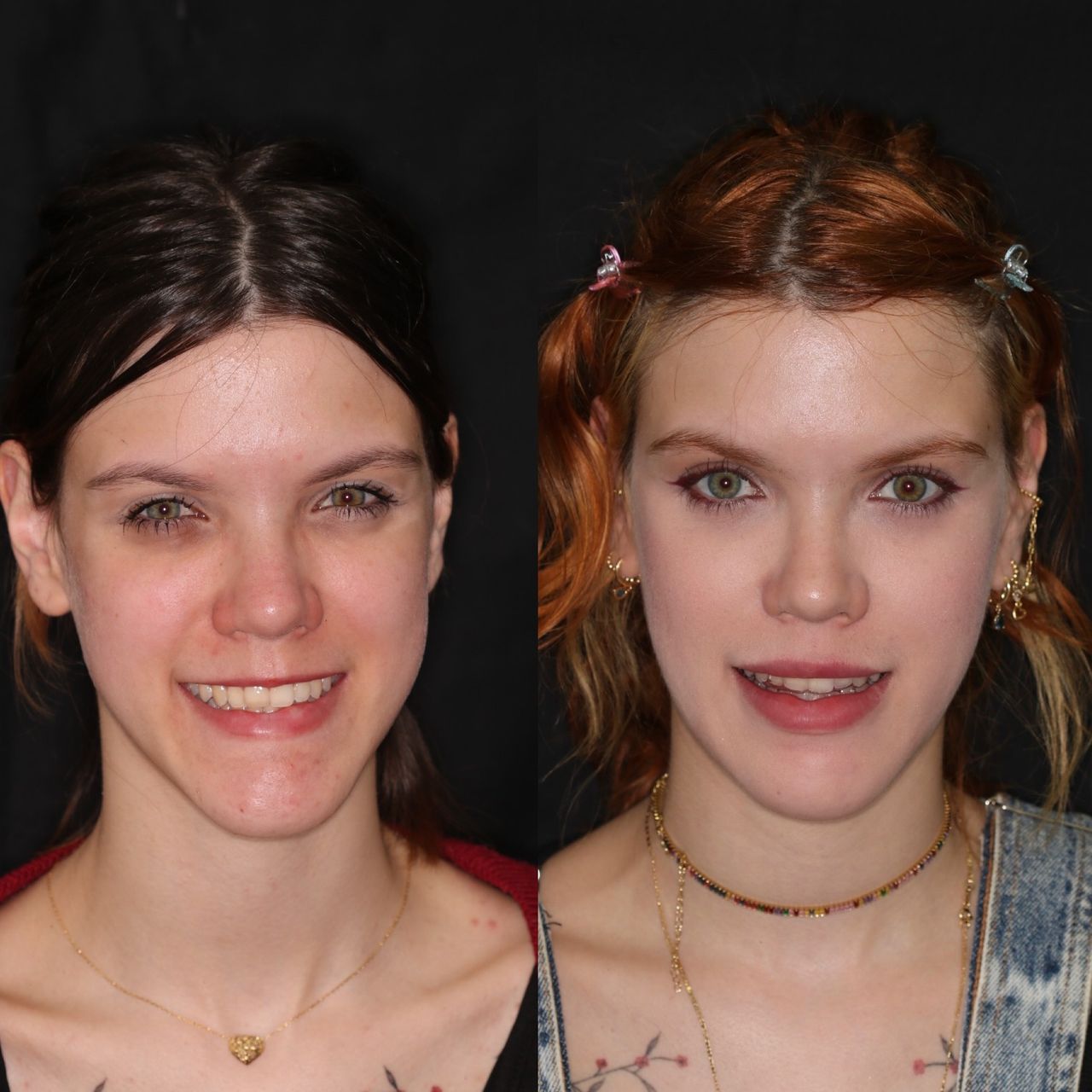 Bruno Nifossi Prado-25