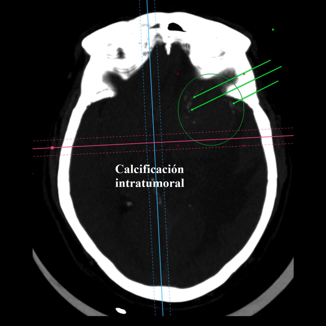 David Tafur Muñoz-2038