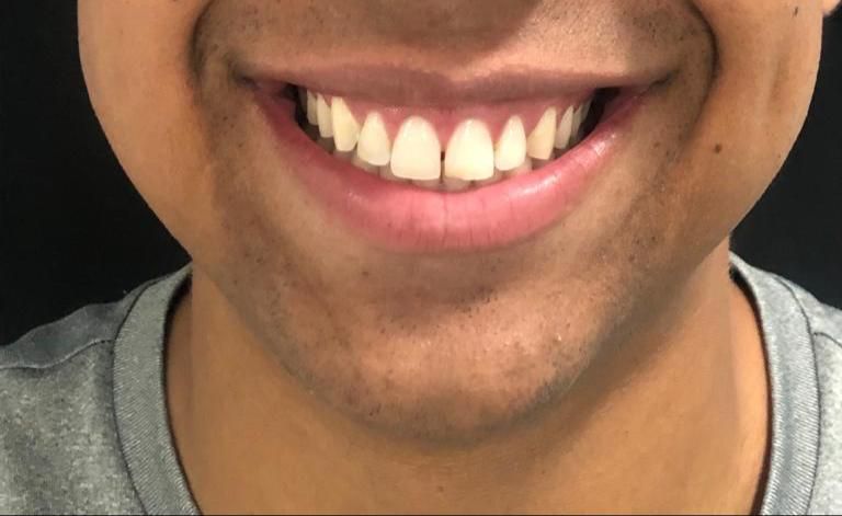 Saulo Fernandes-2