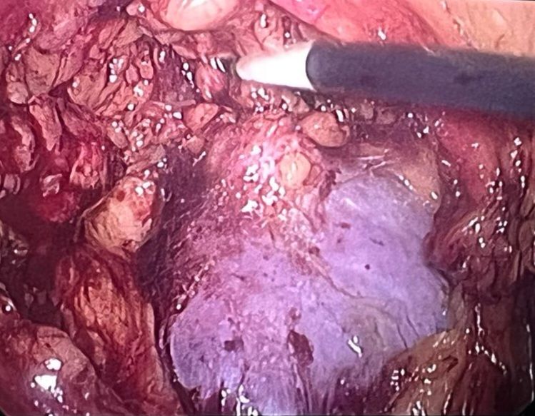 Leonardo Gastón De Oliveira-22