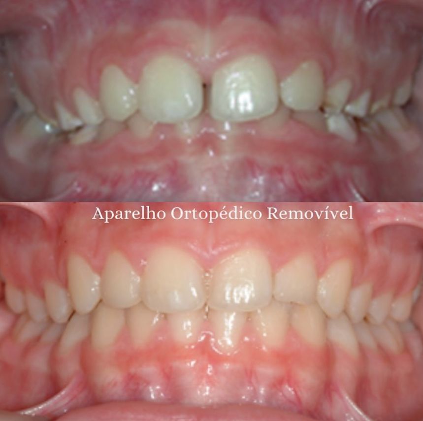 Hermenegildo Mancini-2