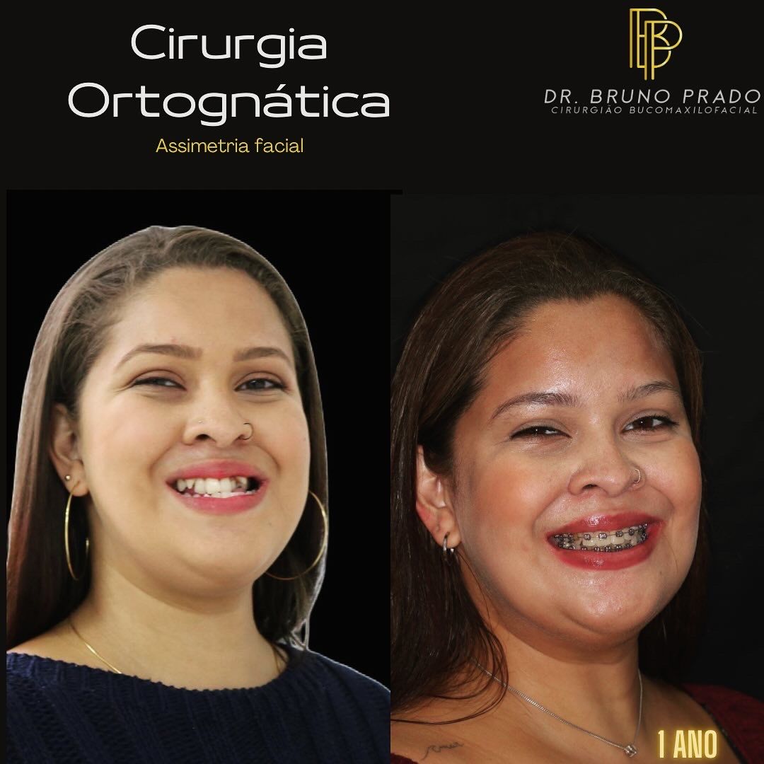 Bruno Nifossi Prado-34