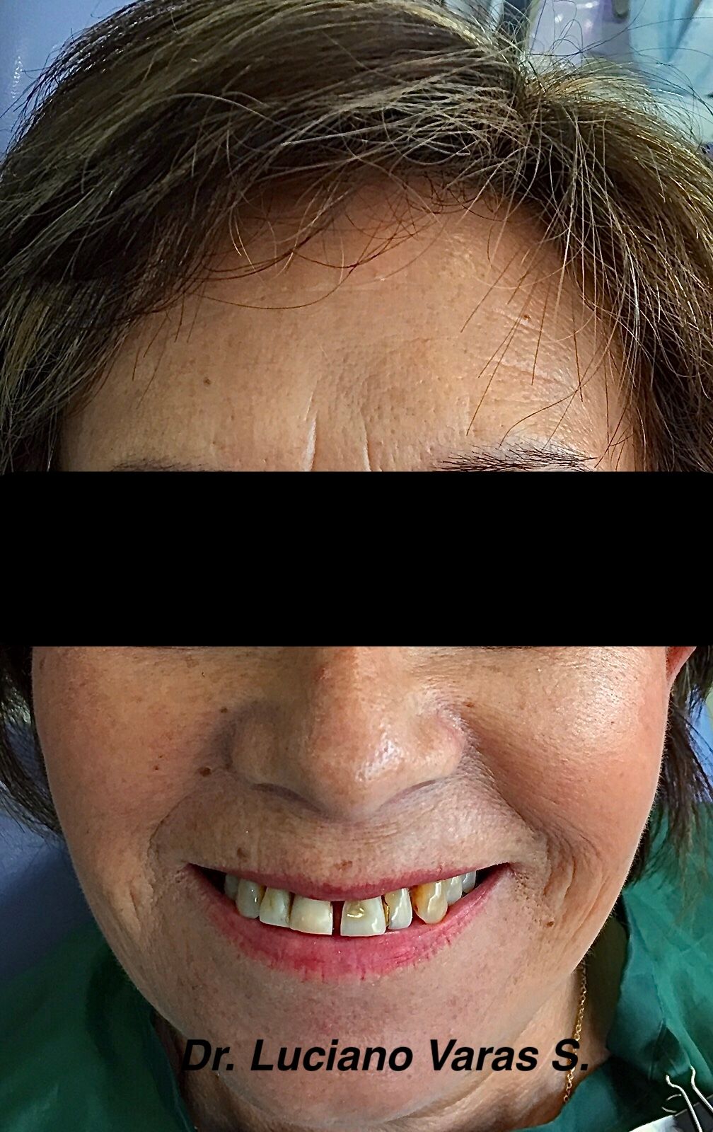 Luciano Varas Salinas-16