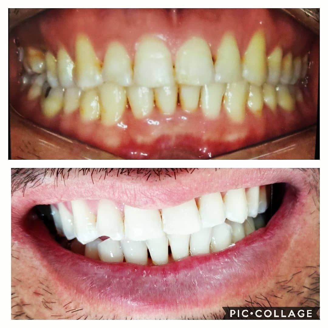 Rosemary Carneiro De Sá-46