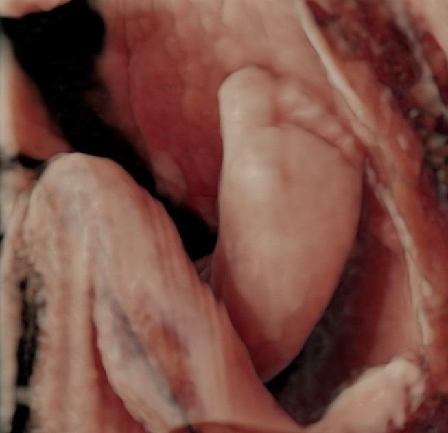 Charles Schwantz De Lima-32