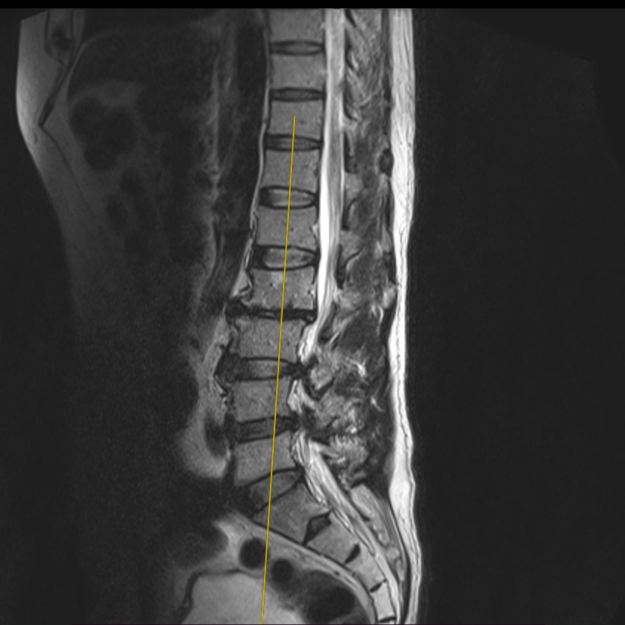 David Tafur Muñoz-1677