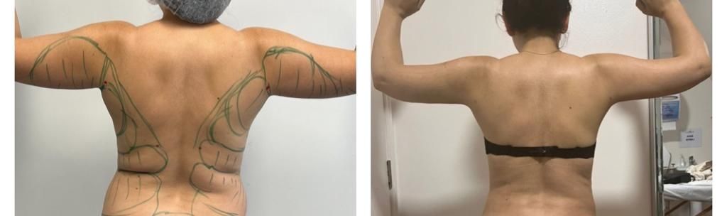 Fernando Oviedo Monsalve-3