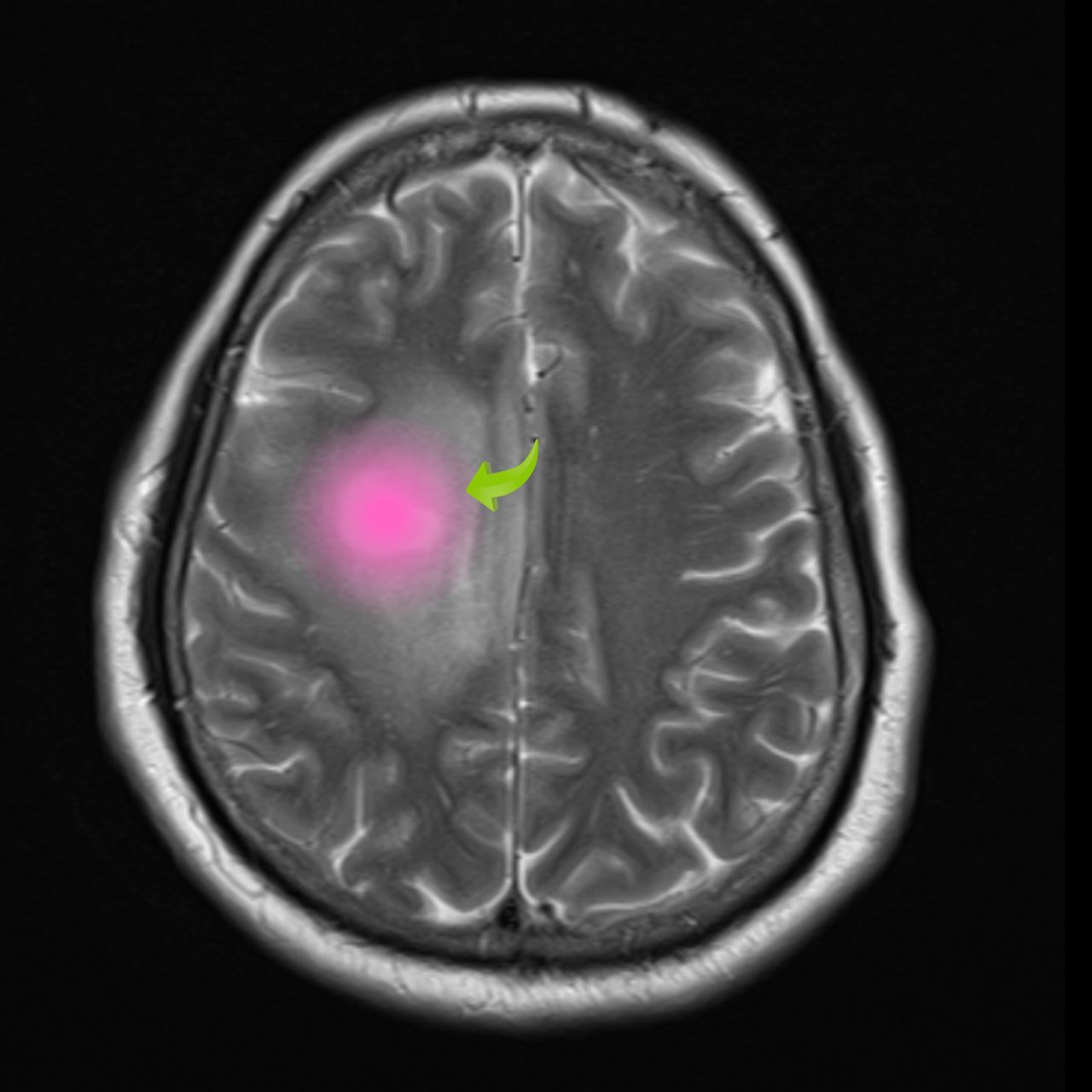 David Tafur Muñoz-1653