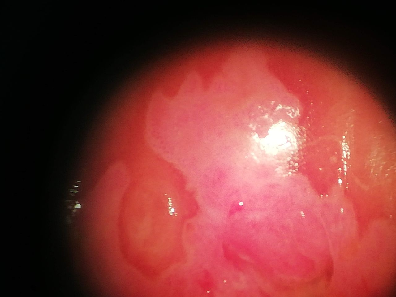 David Stivel Pinzón Garcia-3