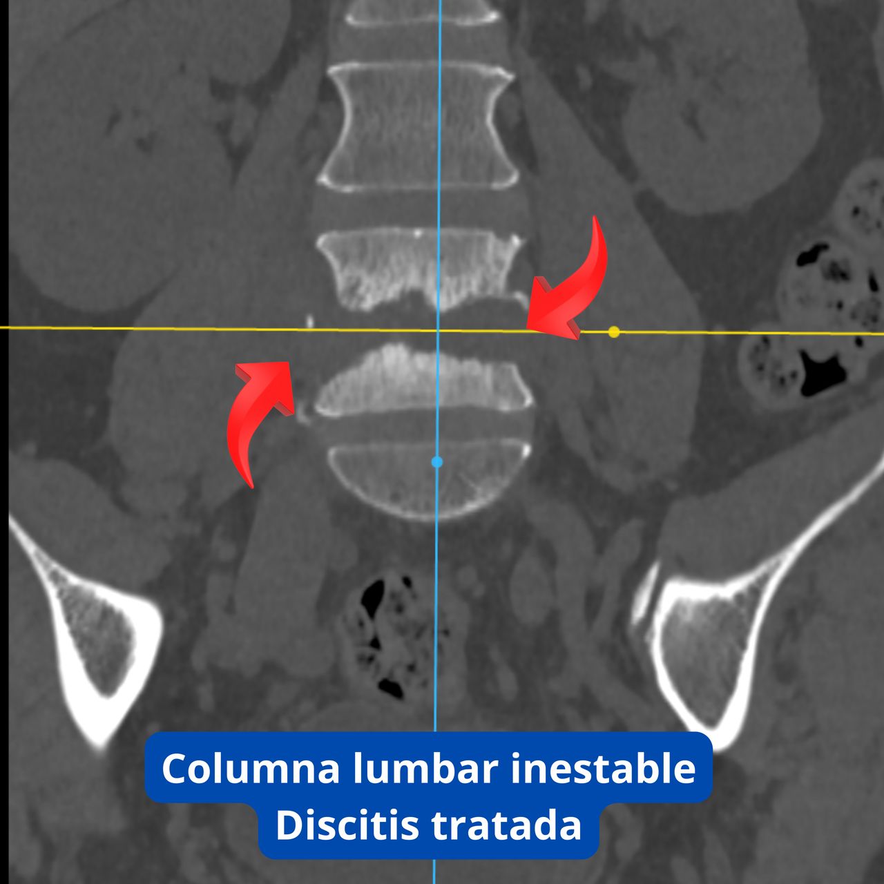 David Tafur Muñoz-1928