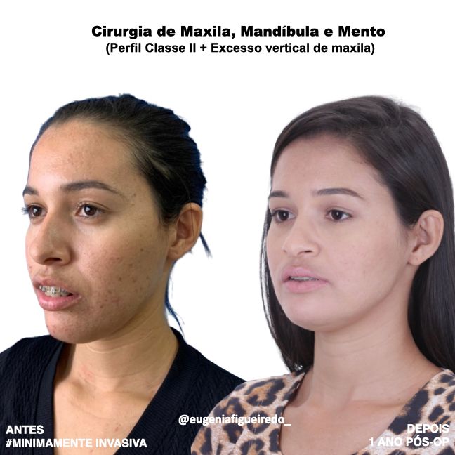 Eugênia Figueiredo-33
