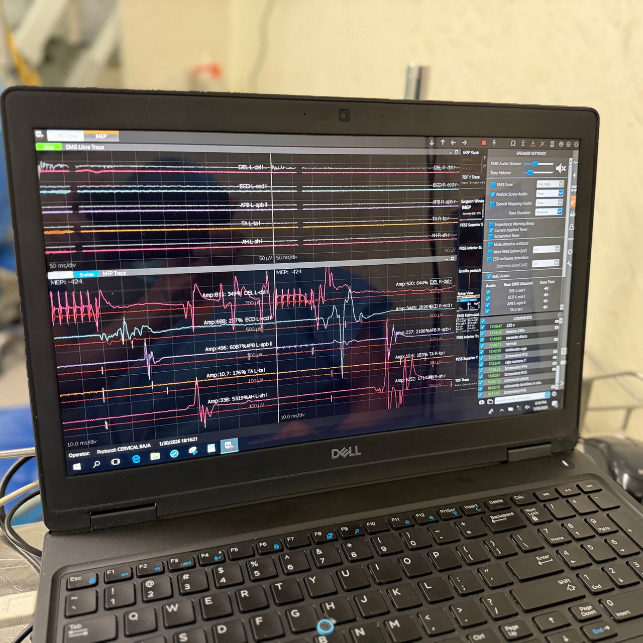 David Tafur Muñoz-2439