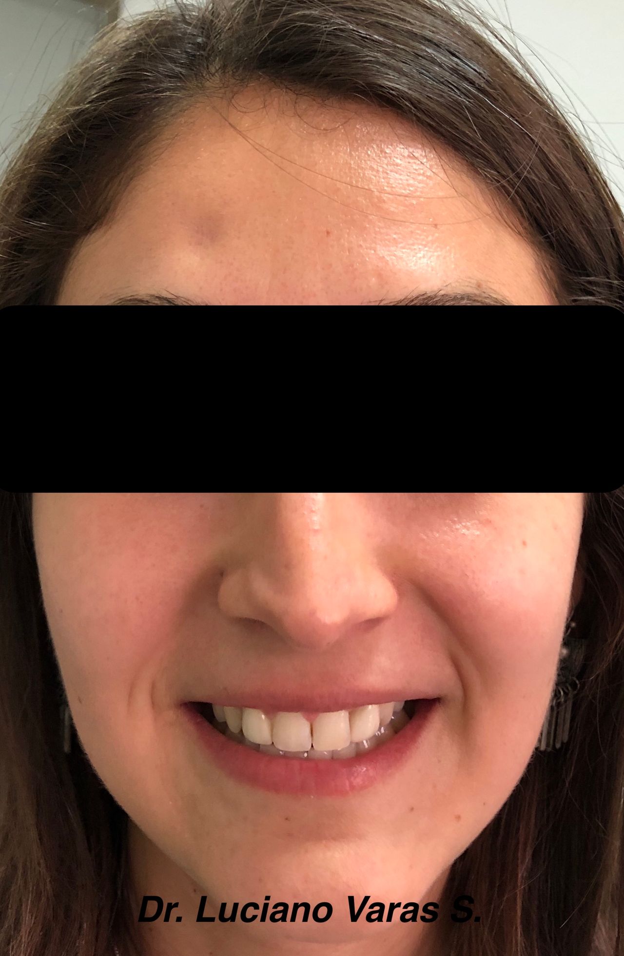 Luciano Varas Salinas-11