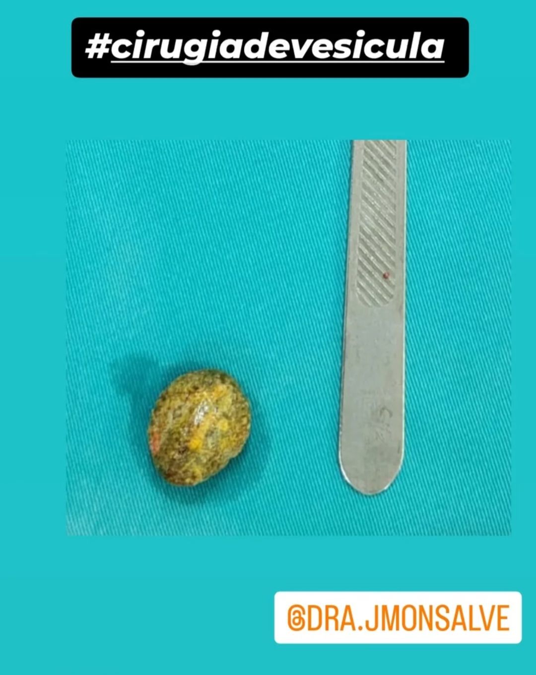 Joana Monsalve Nieto-5