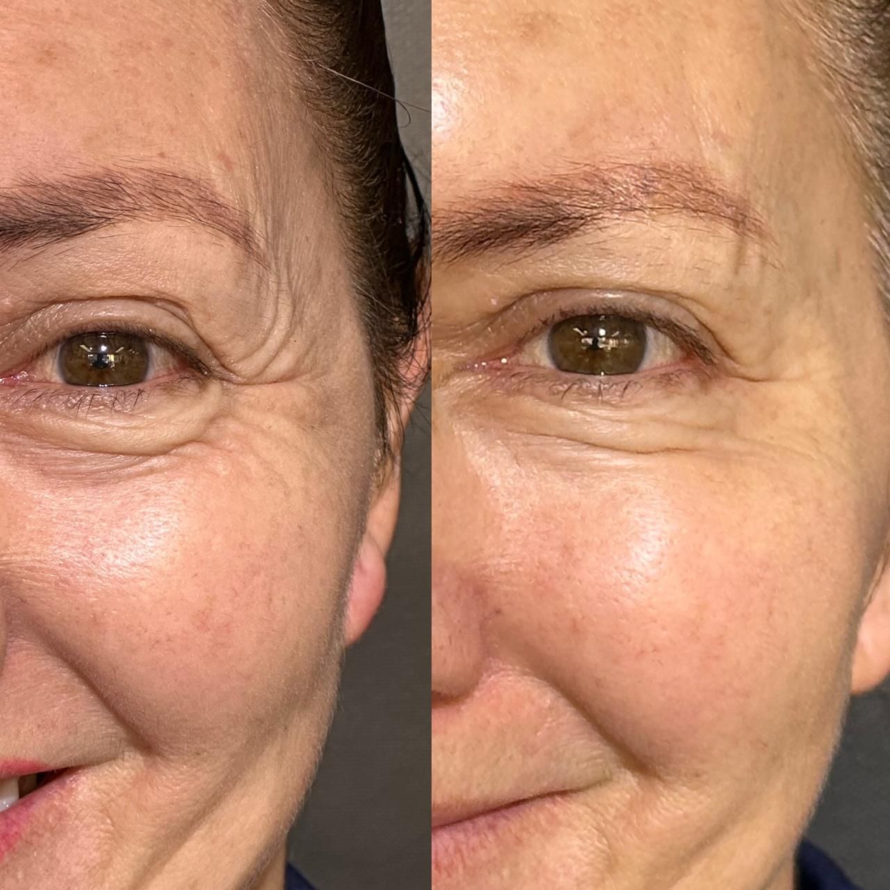 Andrés Felipe Barreto Galeano-26