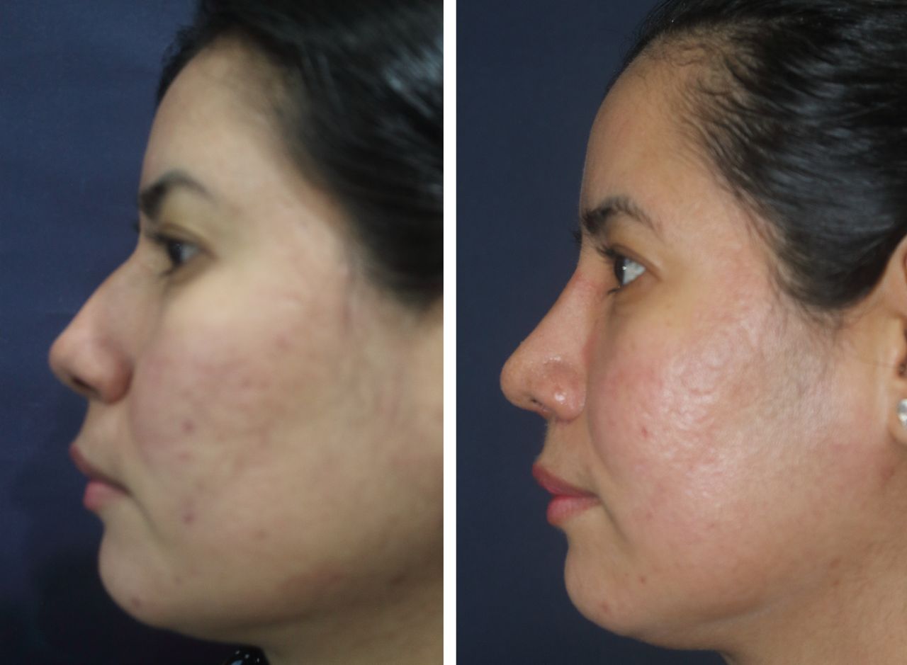 Jorge A Holguin Ruiz-29