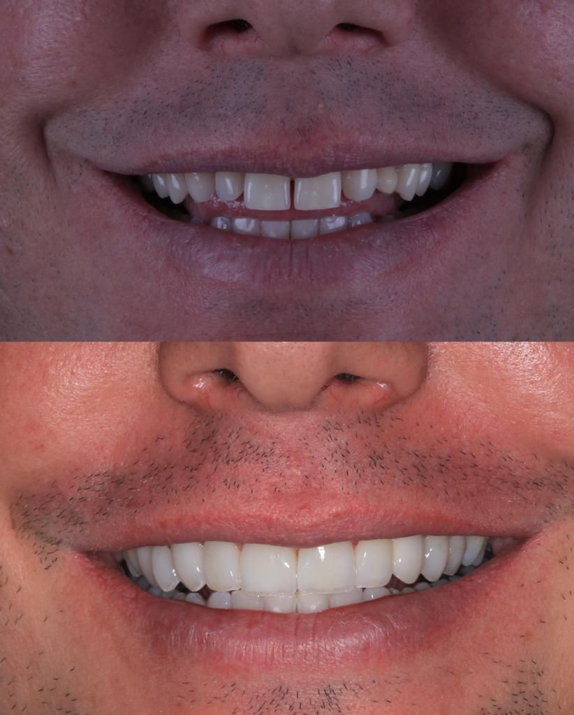 Lidiane Morais Mendes-11