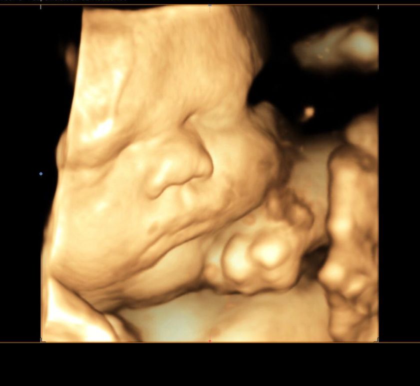 Jonh Harold Alvis Botello-15