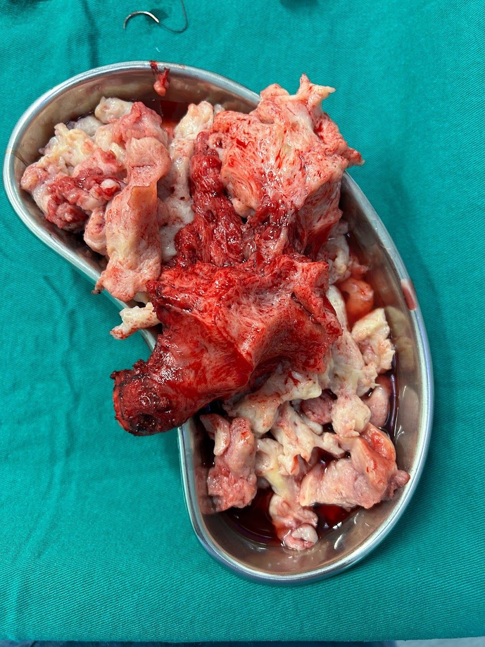 Adalberto Cesario Pereira Junior-61