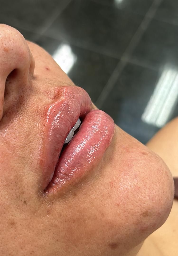 Hermenegildo Mancini-3