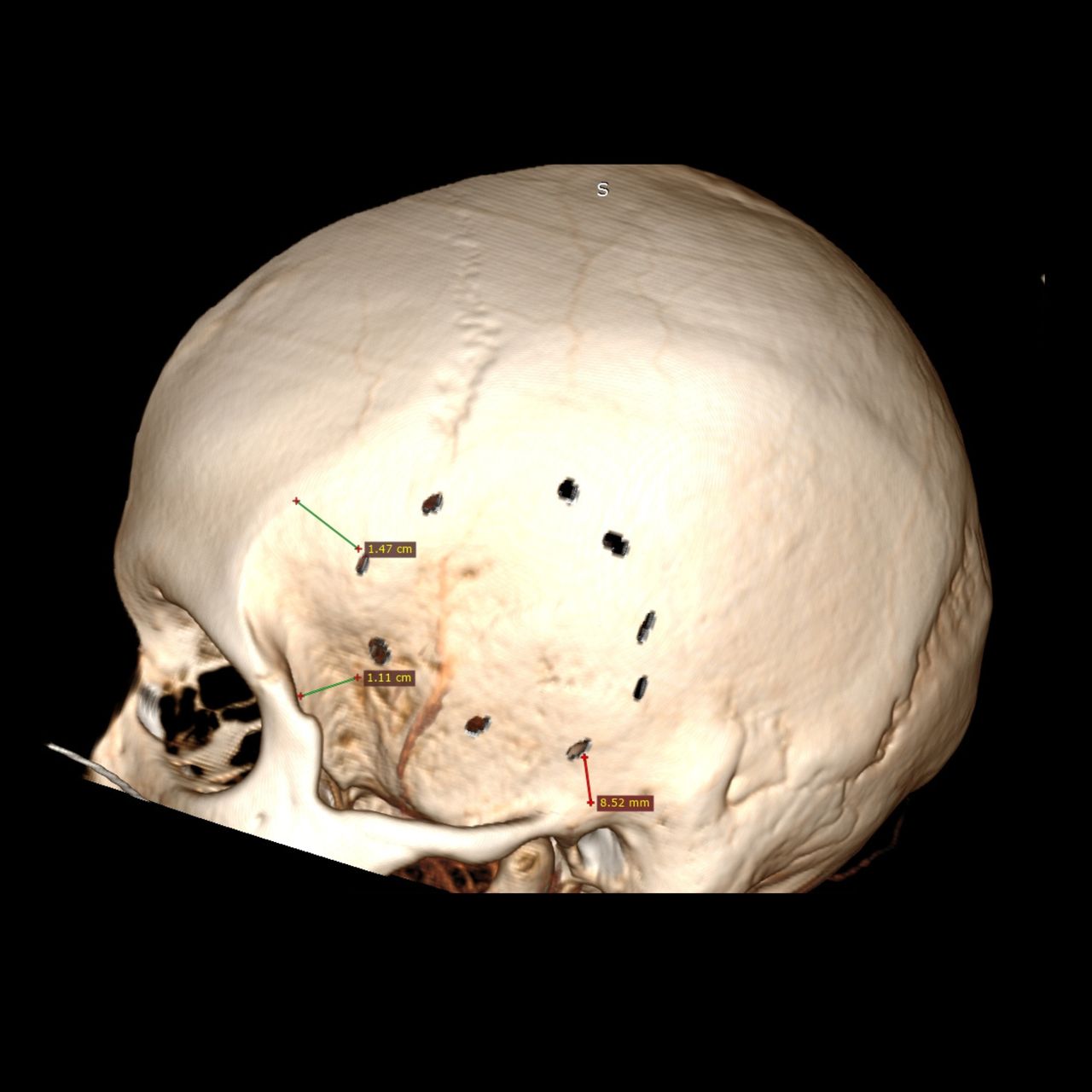 David Tafur Muñoz-1258