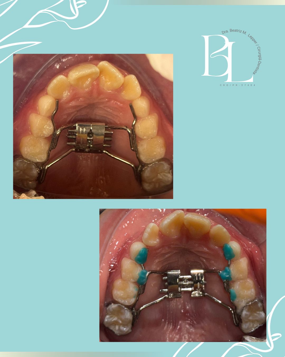 Beatriz Mendonça Lepper-3