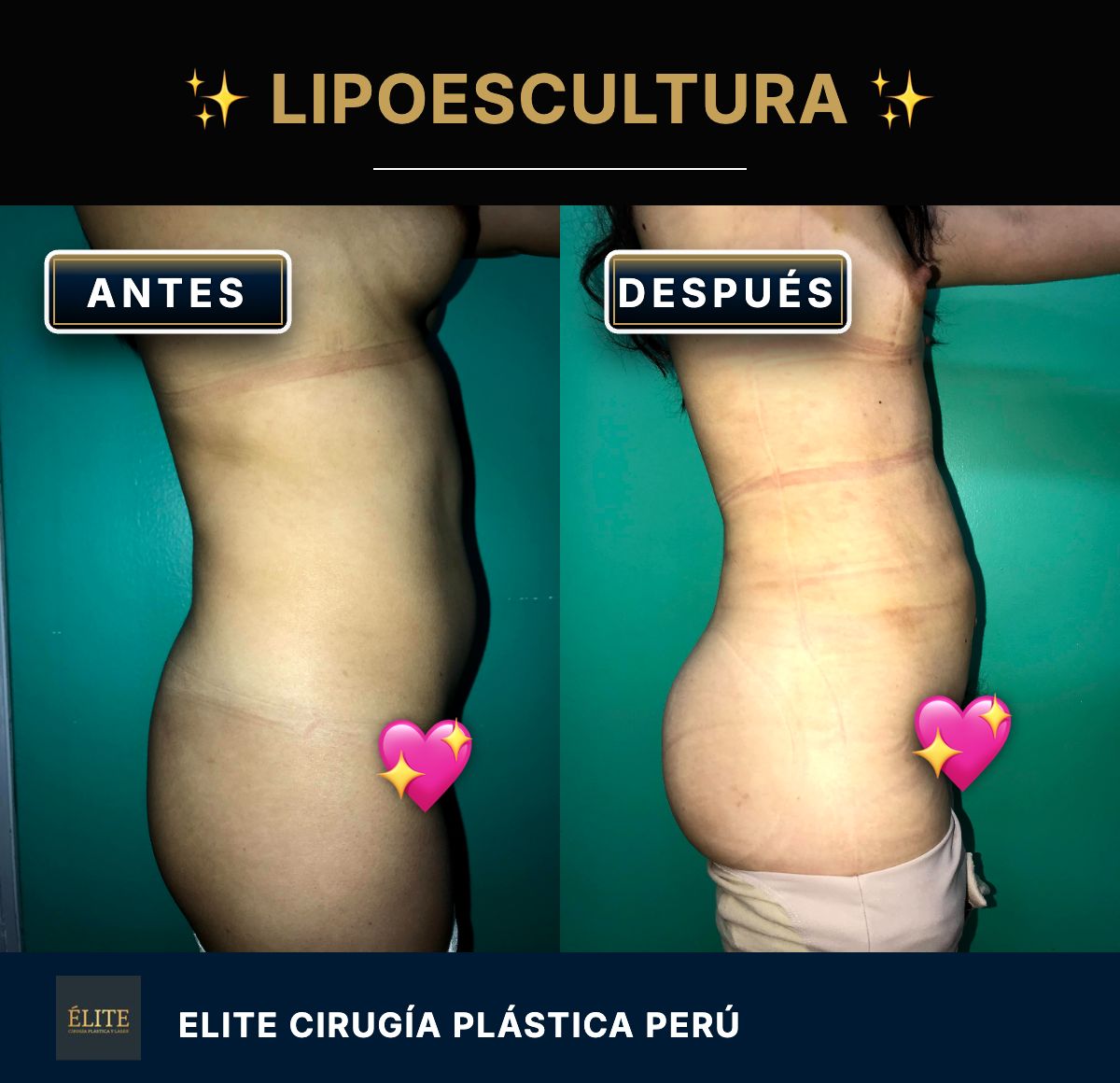 Roberto Alexander Rodriguez Zuñiga-6