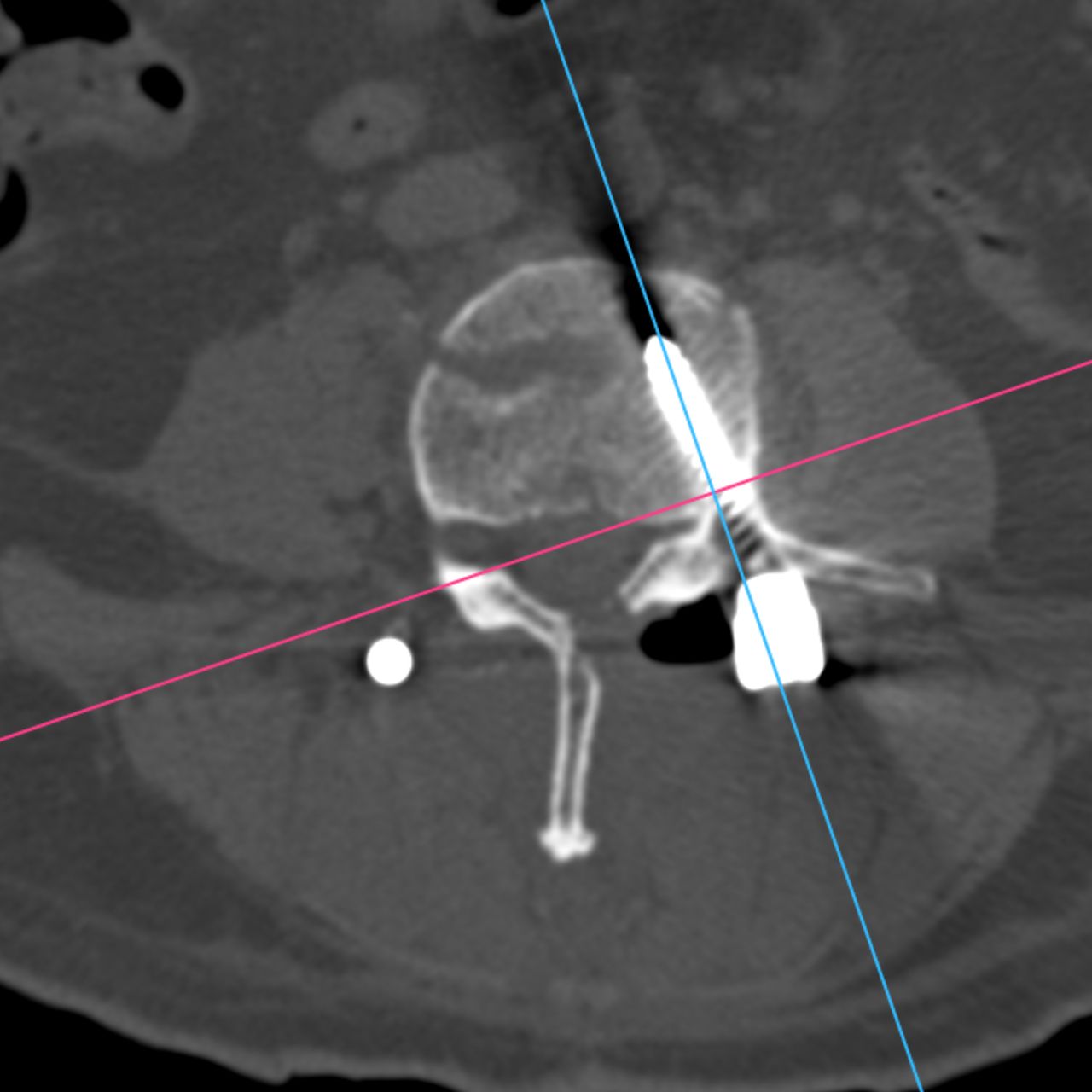 David Tafur Muñoz-1844