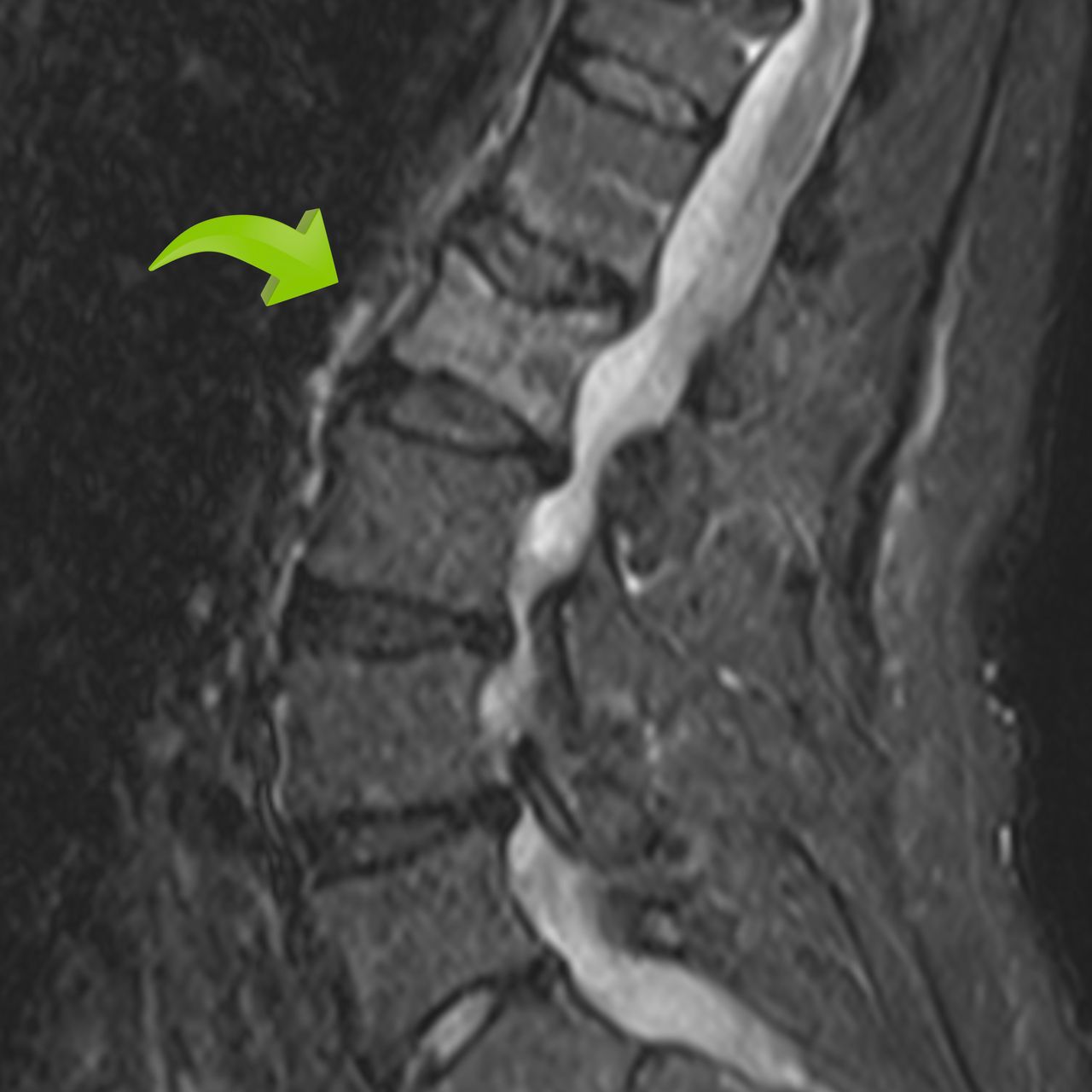 David Tafur Muñoz-1148