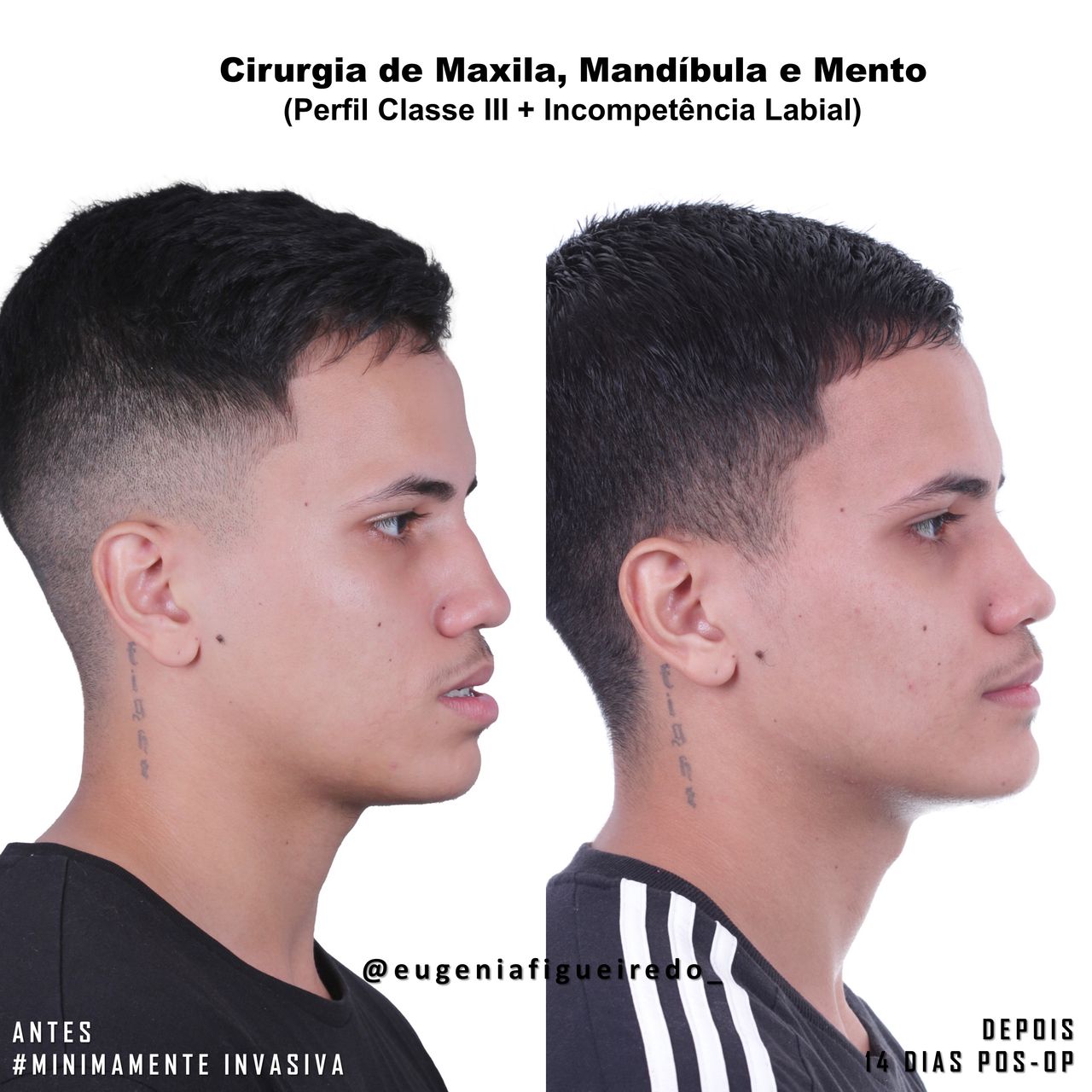 Eugênia Figueiredo-9