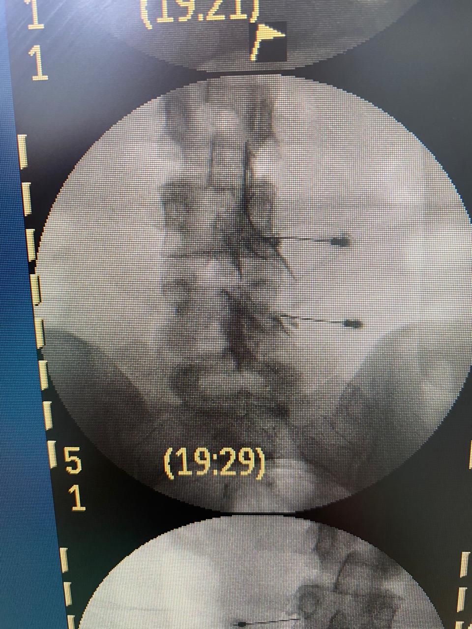 Victor Fontes Pacheco-6