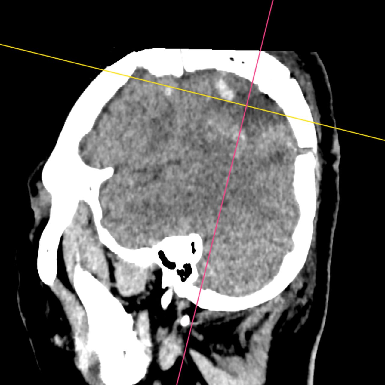 David Tafur Muñoz-1892