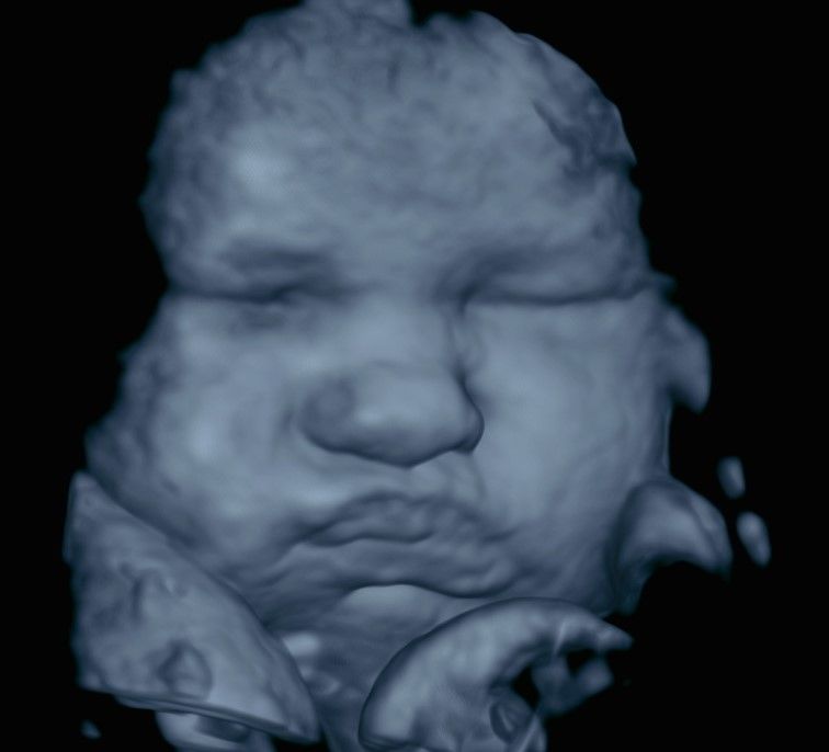 Charles Schwantz De Lima-14