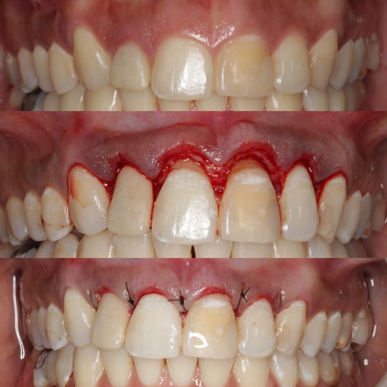 Antônio Alegria Do Nascimento-6