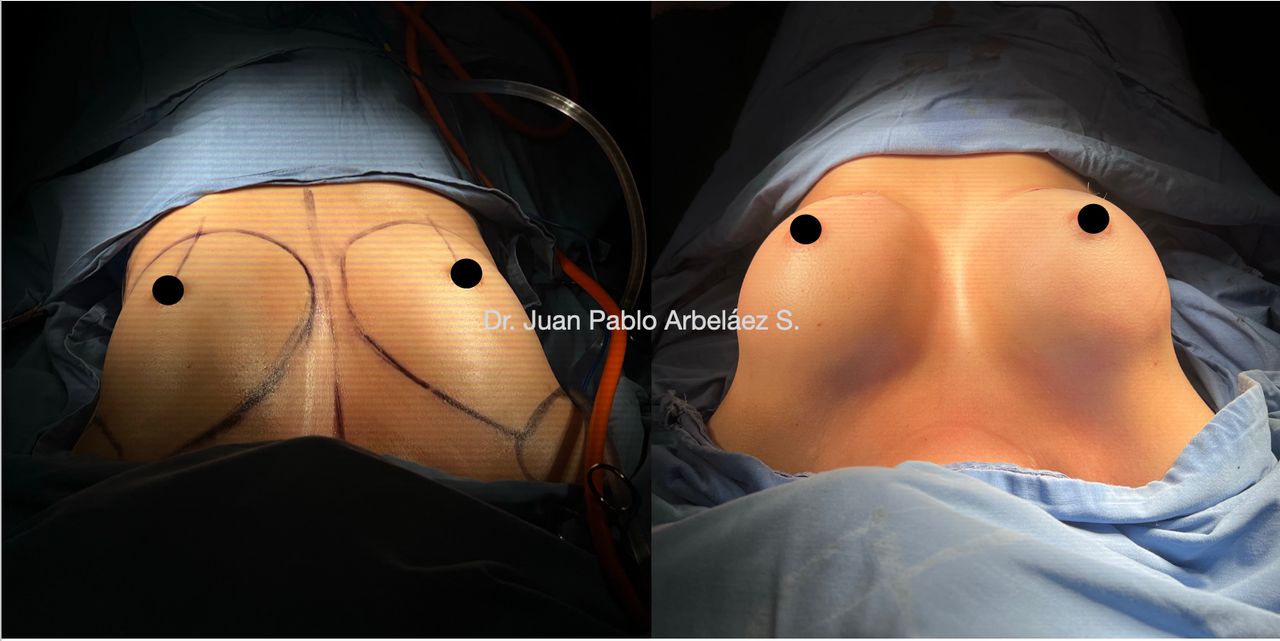 Juan Pablo Arbeláez Sierra-44