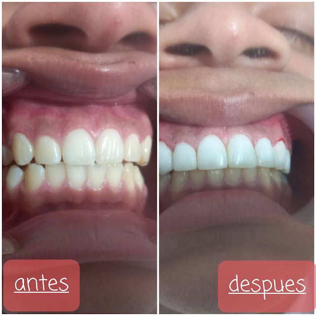 Rodolfo Nelson Olivo Gutierrez-14