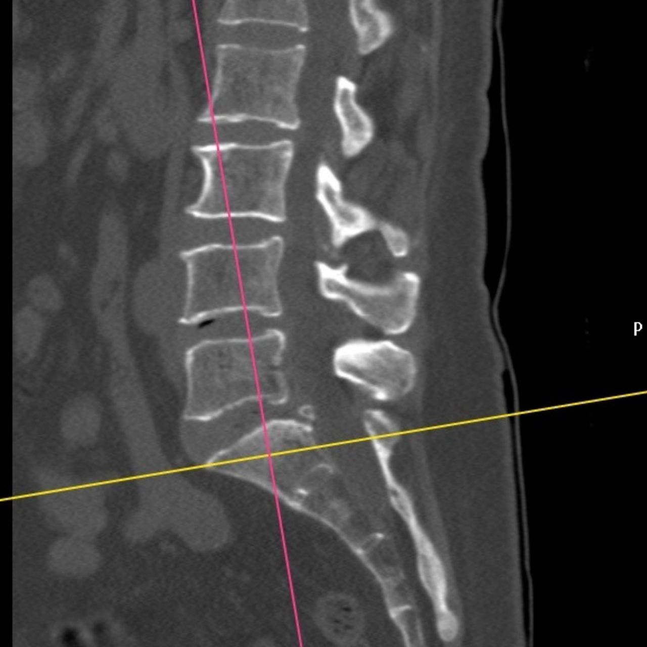 David Tafur Muñoz-1469