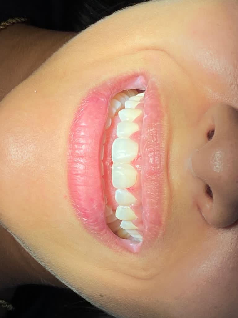 Francisco De Assis Almeida Lima Júnior-23