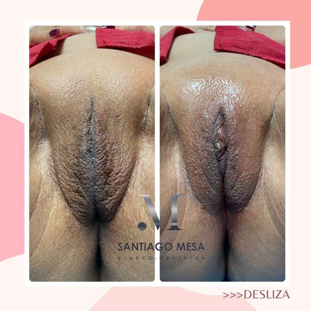 Mario Santiago Mesa Espinel-10