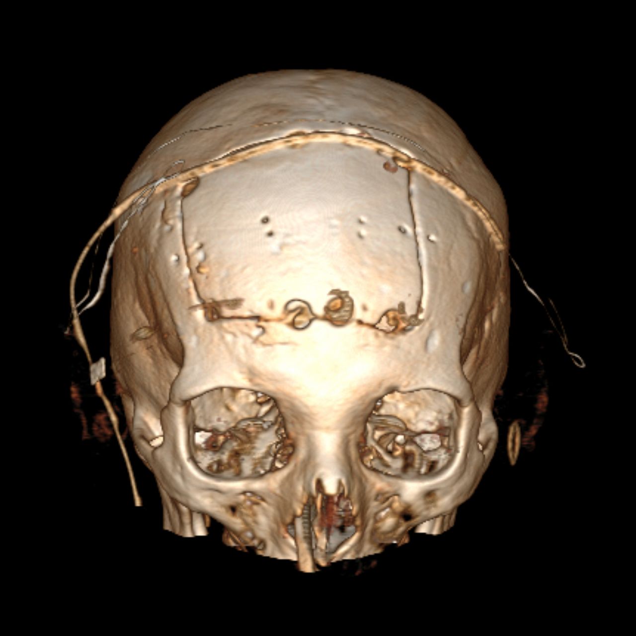 David Tafur Muñoz-1280