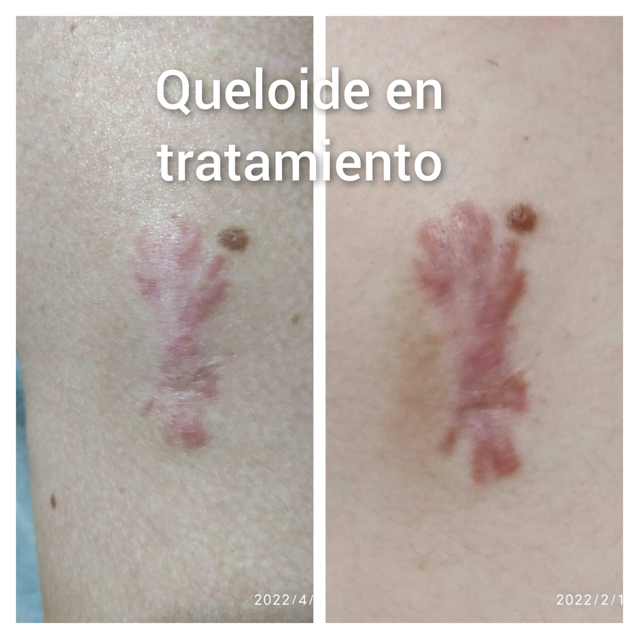 Alejandra Meijide-15