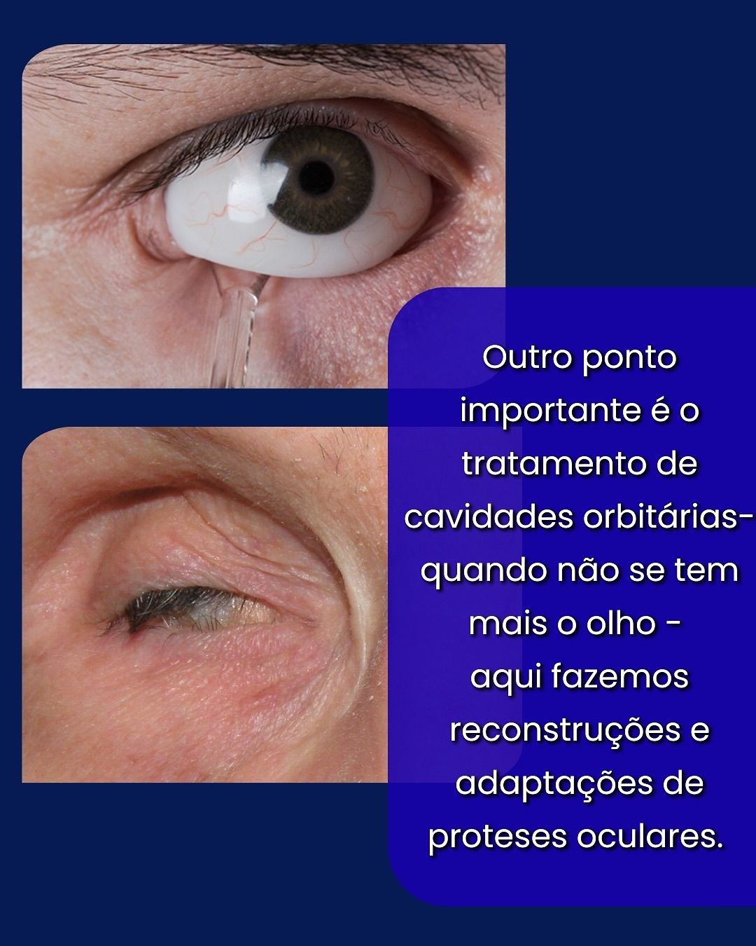 Araê De Oliveira-11