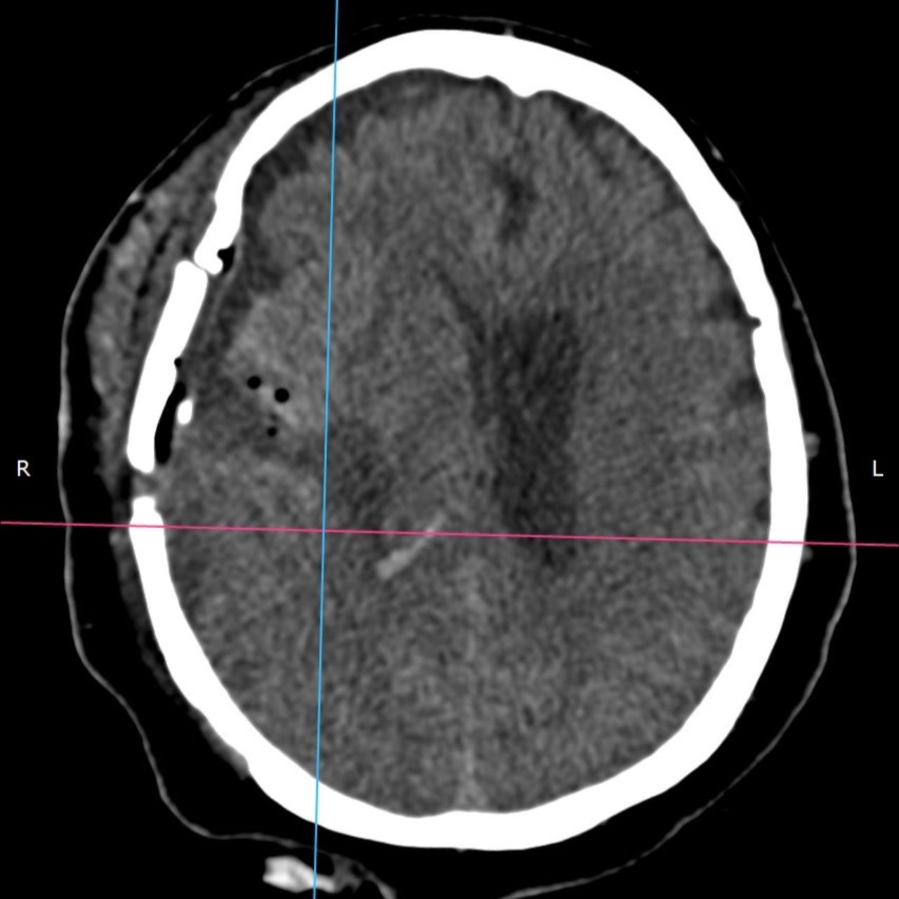 David Tafur Muñoz-1620