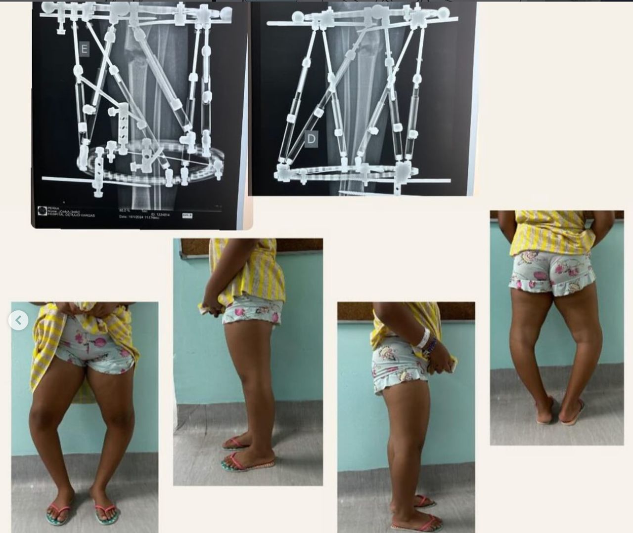 Iuri De Brito Nóbrega Silva-1